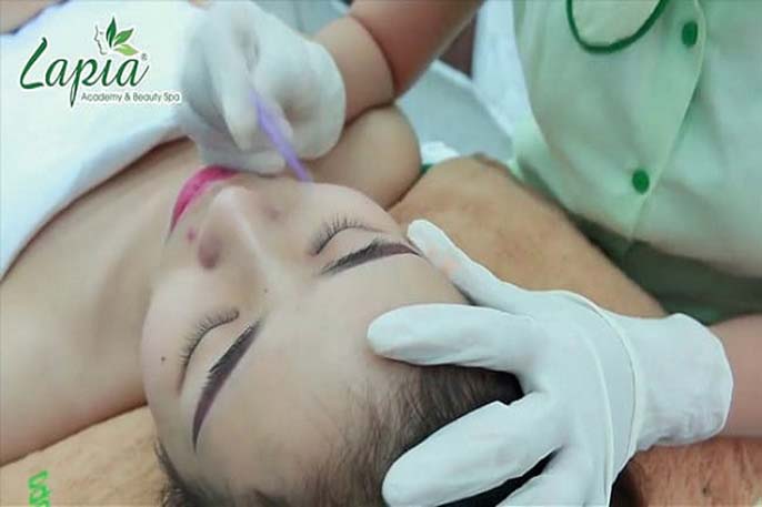 Top 5 spa trị mụn lưng uy tín TPHCM bạn nên xem ngay