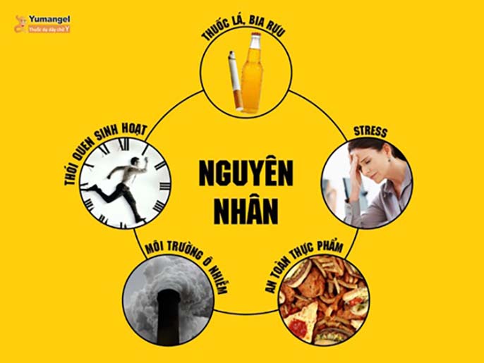 Bí kíp giúp dân văn phòng thoát khỏi cảnh đau dạ dày rình rập