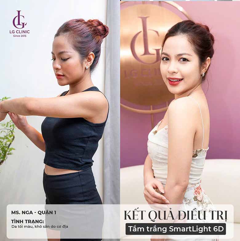 Top 5 Spa tắm trắng uy tín, hiệu quả, an toàn tại TPHCM
