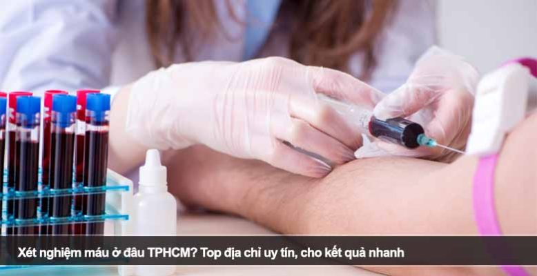 Xét nghiệm máu ở đâu TPHCM? Top địa chỉ uy tín, cho kết quả nhanh